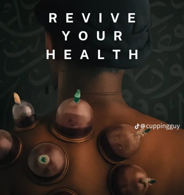 Revive your health with cupping